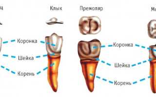 Брекеты на клыки — можно ли исправить такой дефект?