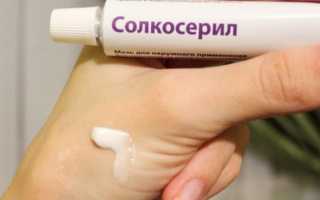 Помогает ли Солкосерил от акне и пятен после прыщей