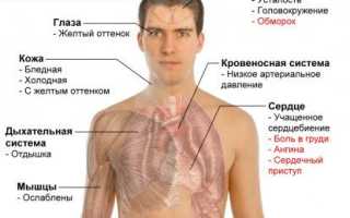 Типы головокружений и средства избавления от вертиго перед месячными