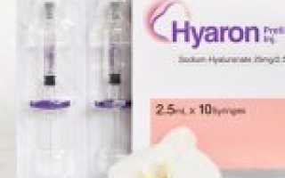 Особенности процедуры биоревитализации препаратами Hyaron
