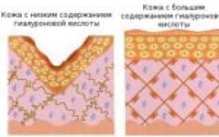 5 Гиалуроновых мазей: крем гиалурон ZD для кожи, глаз и декольте, для умывания с гиалуроновой кислотой