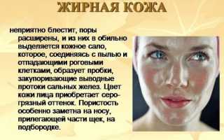 Рецепты масок для жирной кожи лица: избавляемся от блеска, расширенных пор, прыщей